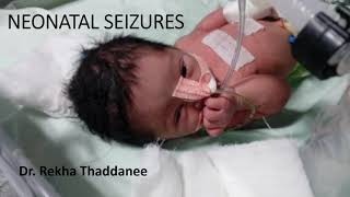 Neonatal Seizures  Pediatrics [upl. by Oderfla]