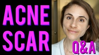 ACNE SCAR QampA laser peels microneedling creams silicone 💊 [upl. by Eylk298]