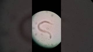 HookwormAncyclostoma Rhabditiform larvae Canine [upl. by Nileuqcaj]