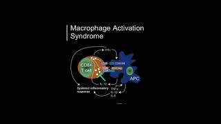 🍁 Macrophage Activation Syndrome 🍁 [upl. by Marilla]