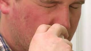 Ear Blackhead Extraction  Dr Steven Greene in Seattle [upl. by Ynoyrb]