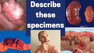 How to describe gross pathology specimens [upl. by Humfrey]