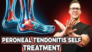 How To Fix Patellar Tendonitis No More Pain amp Self Treatment [upl. by Talanian]