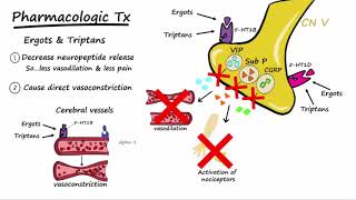 What is Migraine Disease [upl. by Ruffi]