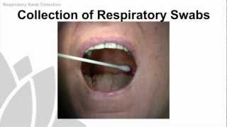 Nasopharyngeal Swab for COVID19 [upl. by Galatea202]