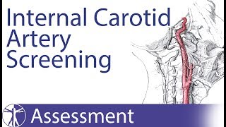 Anterior Cerebral Artery Stroke [upl. by Lytsirhc623]