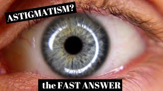 Astigmatism Explained in One Minute [upl. by Gavrielle]