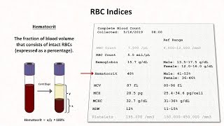 How to Interpret RBC Indices eg hemoglobin vs hematocrit MCV RDW [upl. by Bruni]