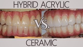 Whats the difference between acrylic and ceramic  Patients Ask [upl. by Correna]