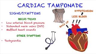 Cardiac Tamponade [upl. by Margalo847]