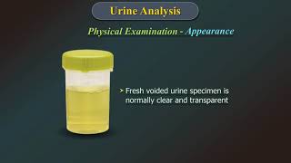 Urine Analysis [upl. by Lamrej]