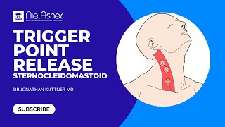 Trigger Point Therapy  Sternocleidomastoid SCM [upl. by Medwin]