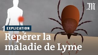 Maladie de Lyme  comment la repérer [upl. by Imeaj5]