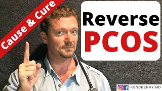 PCOS What Causes PCOS How to Reverse PCOS [upl. by Lantha]