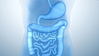 What Are Colon Polyps [upl. by Druci]