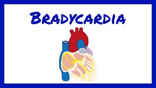 Bradycardia  Bradyarrhythmia [upl. by Celeski936]