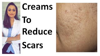 How to remove scars  Scar creams  tretinoin  Tazarotene  dr Aanchal  Dermatologist [upl. by Tammara]