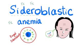 Sideroblastic Anemia [upl. by Rika]