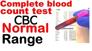 Complete blood count or CBC test normal range [upl. by Nwhas]