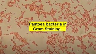 Pantoea in Gram Staining [upl. by Oliric]