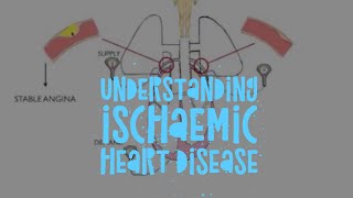 The pathophysiology of ischaemic heart disease [upl. by Anilad]