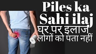 Piles treatment at home in Hindi  Bavasir ka ilaj [upl. by Ydissahc936]