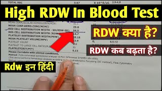 Rdw blood test hindi  High RDW In Blood Test  Rdw test means  Rdw test report [upl. by Heath]