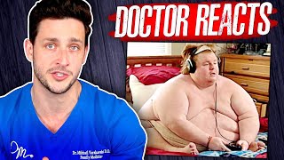 The Harsh Reality Of Being 800 Pounds  Doctor Reacts [upl. by Weatherley]