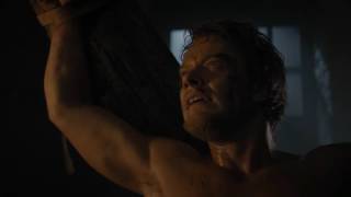 Game of Thrones Theons poor leg YTP [upl. by Ytteb]