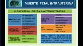 MUERTE FETAL INTRAUTERINA [upl. by Allemap]