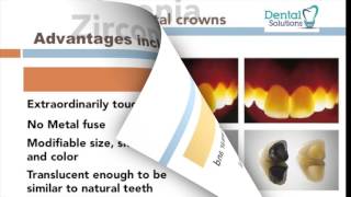 Zirconia crowns vs Porcelain Metal Crowns PMC [upl. by Otrebogir]