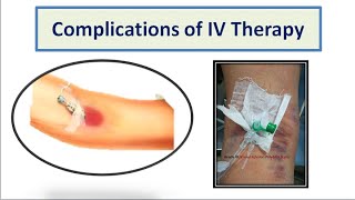 Complications of IV Therapy [upl. by Colis]