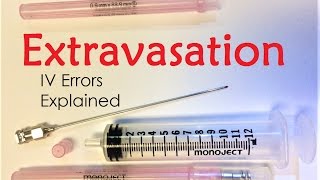 Extravasation  IV Infiltration Errors Explained Doctor Interview [upl. by Rosenblatt]