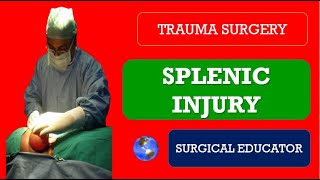 SPLENIC INJURY  How to DIAGNOSE amp TREATBlunt Injury Abdomen  Trauma Surgery [upl. by Aaberg893]