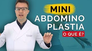 MINI ABDOMINOPLASTIA O Que É  Dr Flávio Quinalha [upl. by Nawram]