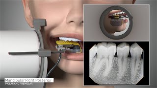 DEXIS™ Titanium by KaVo  Full Mouth Series Positioning Guide [upl. by Siurad]