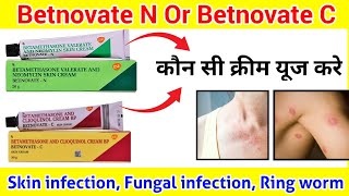 Skin Cream ll Difference between Betnovate N and Betnovate C cream ll How to use Betnovate N ll [upl. by Nitsirc24]