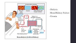 Disorders of Excretory System  Haemodialysis Artificial Kidney  Biology Class 11NEET [upl. by Halsy926]