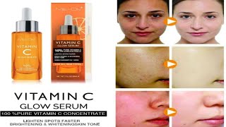 me on vitamin c glow serum  glow skin ke liye Best serum llk5ll viralvideo [upl. by Faubion965]