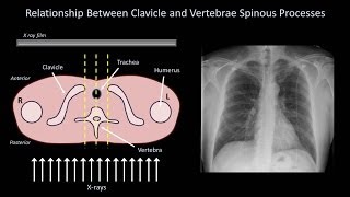 How to Interpret a Chest XRay Lesson 3  Assessing Technical Quality [upl. by Guildroy]