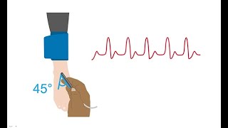 Performing a manual anklebrachial index ABI [upl. by Alica]