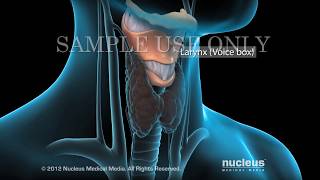 Robotic Thyroidectomy [upl. by Annad104]