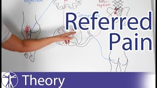 Referred Pain Explained [upl. by Hege]