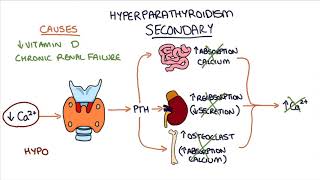 Understanding Hyperparathyroidism [upl. by Akimet]