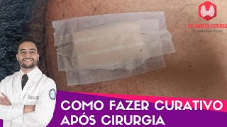 Como fazer curativo após uma cirurgia [upl. by Michi]