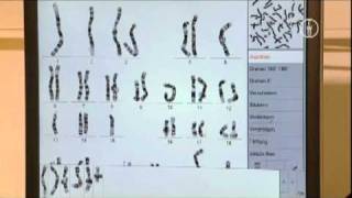 FWU  Chromosomen des Menschen  Erbkrankheiten und Karyogramme [upl. by Smada]