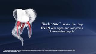 Biodentine  REVERSE THE IRREVERSIBLE [upl. by Nailliw]