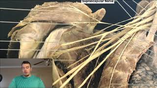 Brachial Plexus EXPLAINED Using a Cadaver [upl. by Olinad316]