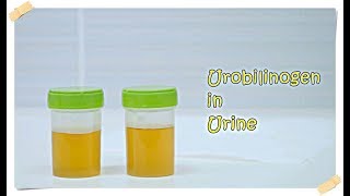 Urobilinogen in Urine [upl. by Neelie901]