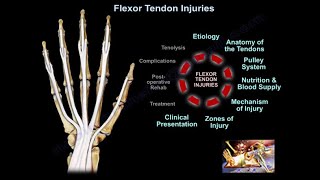 Flexor Tendon Injuries  Everything You Need To Know  Dr Nabil Ebraheim [upl. by Sedicla538]